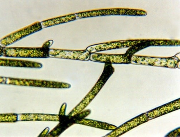 Cladophora sp - Sifonalna alga